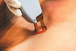 Laser Clinic Compliance in 2026: A Guide to the New Aesthetics Proposals and Laser Safety
