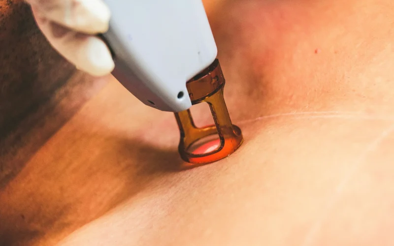 Laser Clinic Compliance in 2026: A Guide to the New Aesthetics Proposals and Laser Safety
